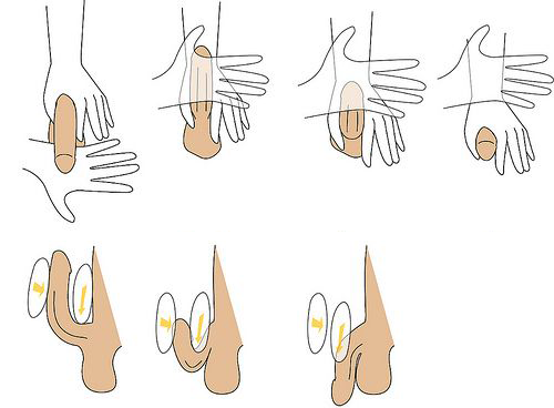 how-to-use-titan-gel