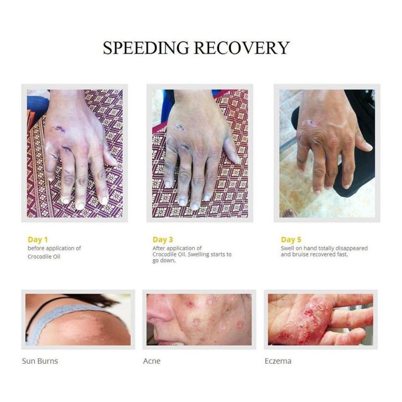 Skin melanin, Skin wrinkle, dry skin, sun spot, dark sports, freckles, eye wrinkle, acne scars, skin elasticity, skin firm, skin radiance,