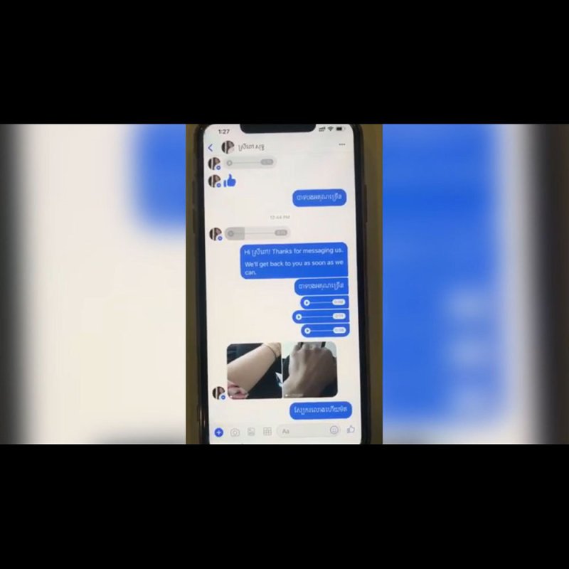 សាច់ស្អាត ស្បែកស្អាត ស្បែកស ស្បែកភ្លឺរលោង សាច់ម៉ដ្ឋចែងចាំង ស្បែកខ្មៅស្រអាប់