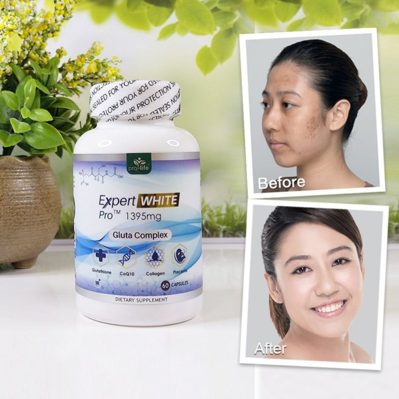 Expert White - Whitening Skin Vitamins
